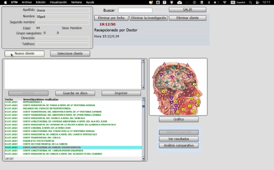 Análisis cerebral