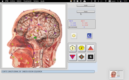 Metaterapia cerebral